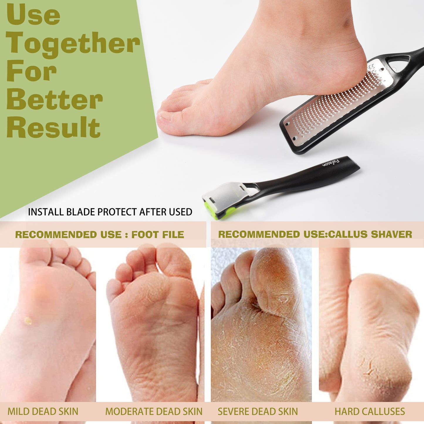 PAFASON® Stainless Steel 304 Foot Files Colossal Foot Scrubber Callus Shaver Heel Scraper Callus Remover Foot Rasp - Pedicure Kit for removing Hard Skin on Wet & Dry Feet Surgical Grade